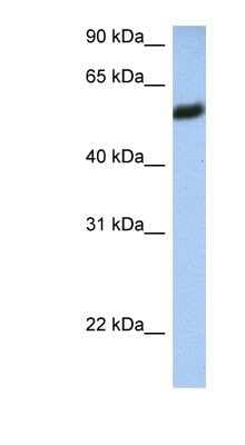 Western Blot: HLA F Antibody [NBP1-59537]