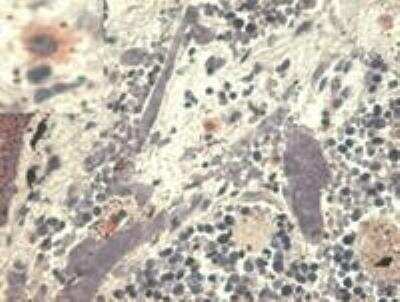 Immunohistochemistry: HLA G Antibody (MEM-G/1) - BSA Free [NB500-302]