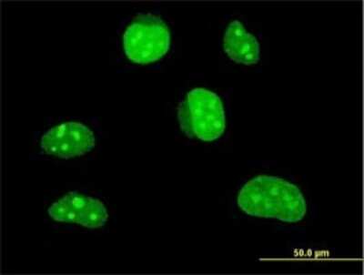 Immunocytochemistry/ Immunofluorescence: HLF Antibody (1F12-1C4) [H00003131-M01]