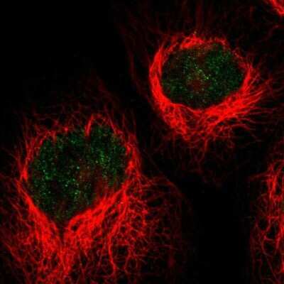 Immunocytochemistry/ Immunofluorescence: HLTF Antibody [NBP1-83256]