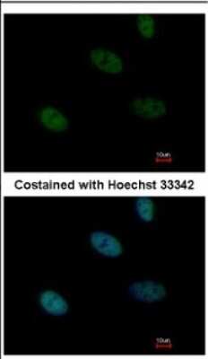 Immunocytochemistry/ Immunofluorescence: HLTF Antibody [NBP2-16857]