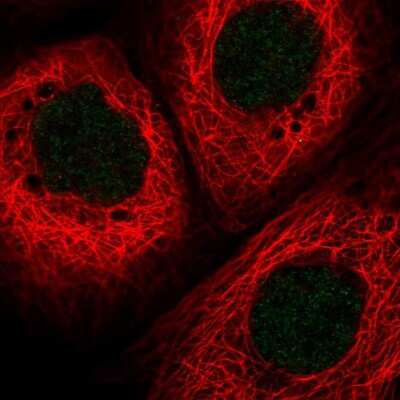 Immunocytochemistry/ Immunofluorescence: HLTF Antibody [NBP2-55017]