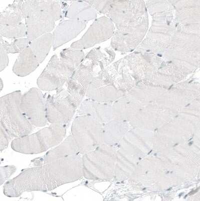 Immunohistochemistry-Paraffin: HLTF Antibody [NBP1-83256]