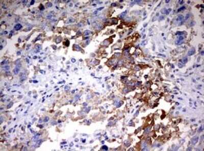 Immunohistochemistry: HMBS Antibody (OTI3F4) [NBP2-45976]