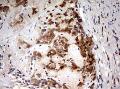 Immunohistochemistry: HMBS Antibody (OTI3F4) [NBP2-45976]