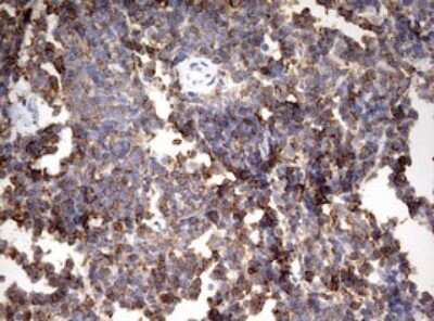 Immunohistochemistry: HMBS Antibody (OTI3F4) [NBP2-45976]