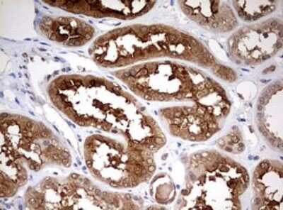 Immunohistochemistry: HMBS Antibody (OTI3F4) [NBP2-45976]