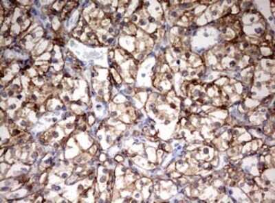 Immunohistochemistry: HMBS Antibody (OTI3F4) [NBP2-45976]