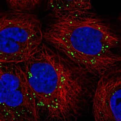 Immunocytochemistry/ Immunofluorescence: HMBS Antibody [NBP2-33600]