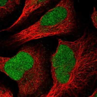 Immunocytochemistry/ Immunofluorescence: HMCES Antibody [NBP2-14410]