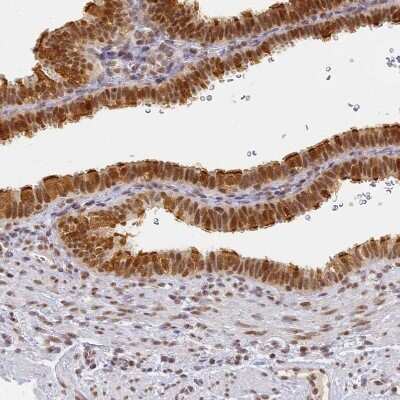 Immunohistochemistry-Paraffin: HMCES Antibody [NBP2-14410]