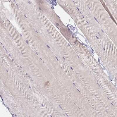 Immunohistochemistry-Paraffin: HMCES Antibody [NBP2-14410]