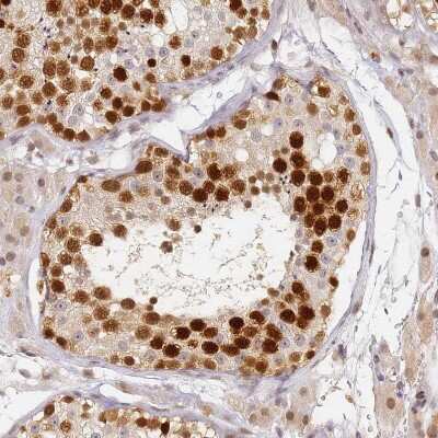 Immunohistochemistry-Paraffin: HMCES Antibody [NBP2-14410]