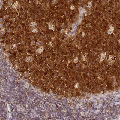 Immunohistochemistry-Paraffin: HMCES Antibody [NBP2-14410]