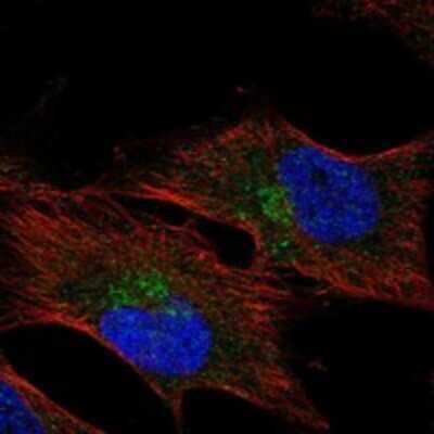 Immunocytochemistry/ Immunofluorescence: HMCN1 Antibody [NBP3-17505]