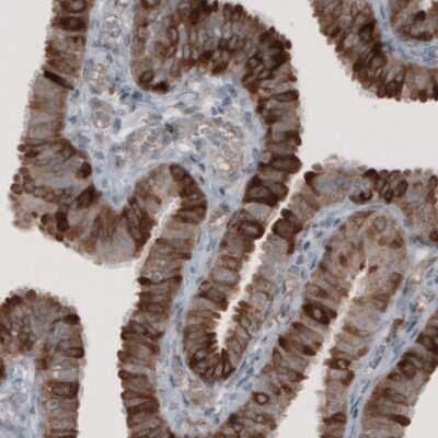 Immunohistochemistry-Paraffin: HMG-CoA Reductase/HMGCR Antibody (CL0259) [NBP2-61616]