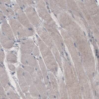 Immunohistochemistry-Paraffin: HMG-CoA Reductase/HMGCR Antibody (CL0259) [NBP2-61616]