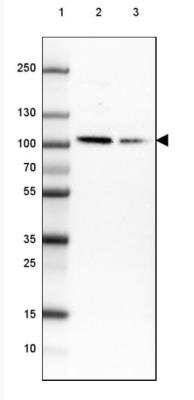 Western Blot: HMG-CoA Reductase/HMGCR Antibody (CL0259) [NBP2-61616]