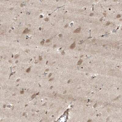 Immunohistochemistry-Paraffin: HMG-CoA Reductase/HMGCR Antibody [NBP1-91996]
