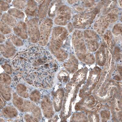Immunohistochemistry-Paraffin: HMG-CoA Reductase/HMGCR Antibody [NBP1-91996]