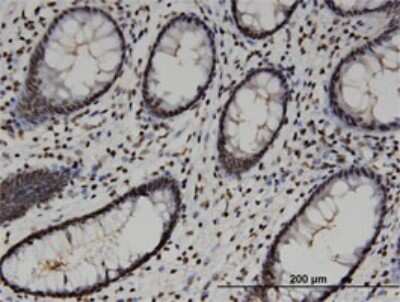 Immunohistochemistry-Paraffin: HMG20A Antibody (4D5) [H00010363-M01]