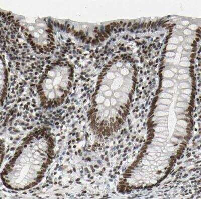 Immunohistochemistry-Paraffin: HMG20A Antibody [NBP1-83833]