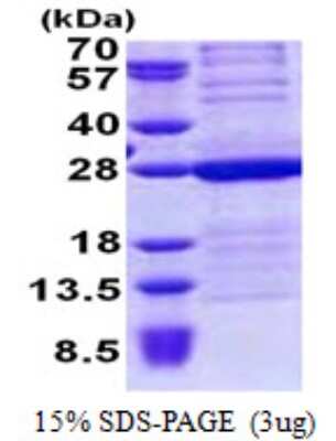 SDS-PAGE: Recombinant Human HMGB3/HMG4 His Protein [NBP2-23123]
