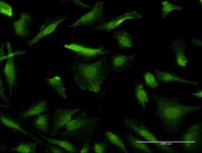 Immunocytochemistry/ Immunofluorescence: HMGA1 Antibody (2A1) [H00003159-M03]