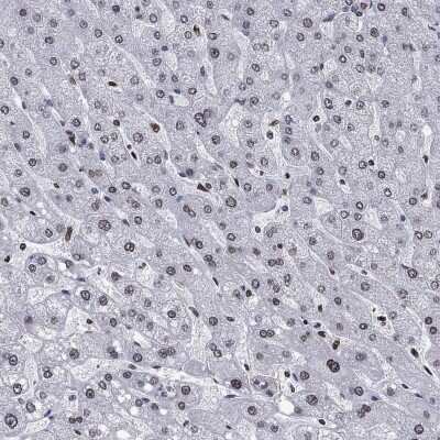Immunohistochemistry-Paraffin: HMGA1 Antibody [NBP3-17055]