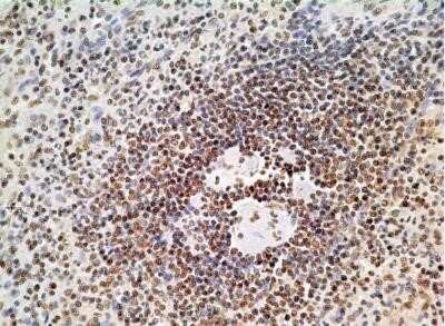 Immunohistochemistry-Paraffin: HMGB1/HMG-1 Antibody (19N10B7) - Azide and BSA Free [NBP2-27395]