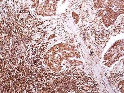 Immunohistochemistry-Paraffin: HMGB1/HMG-1 Antibody (19N10B7) - Azide and BSA Free [NBP2-27395]