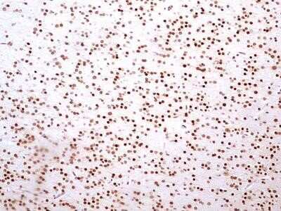Immunohistochemistry-Paraffin: HMGB1/HMG-1 Antibody (19N10B7) - Azide and BSA Free [NBP2-27395]