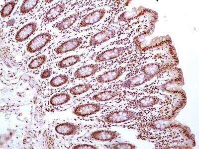 Immunohistochemistry-Paraffin: HMGB1/HMG-1 Antibody (19N10B7) - BSA Free [NBP2-27396]