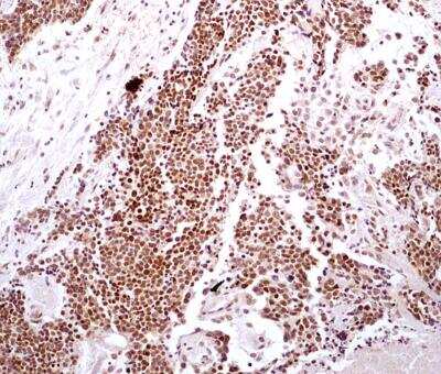 Immunohistochemistry-Paraffin: HMGB1/HMG-1 Antibody (19N10B7) - BSA Free [NBP2-27396]