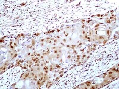 Immunocytochemistry: HMGB1/HMG-1 Antibody (19N15F4) - Azide and BSA Free [NBP2-80775]