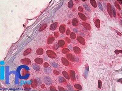 Immunohistochemistry-Paraffin: HMGB1/HMG-1 Antibody (19N15F4) - Azide and BSA Free [NBP2-80775]