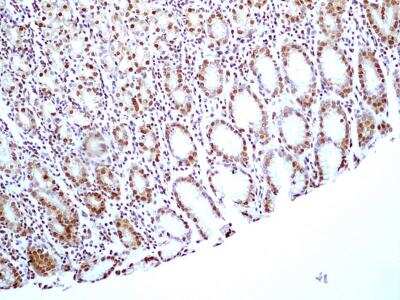 Immunohistochemistry-Paraffin: HMGB1/HMG-1 Antibody (19N15F4) [NBP2-27401]