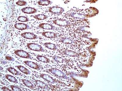 Immunohistochemistry-Paraffin: HMGB1/HMG-1 Antibody (19N15F4) [NBP2-27401]