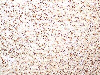 Immunohistochemistry-Paraffin: HMGB1/HMG-1 Antibody (19N15F4) [NBP2-27401]