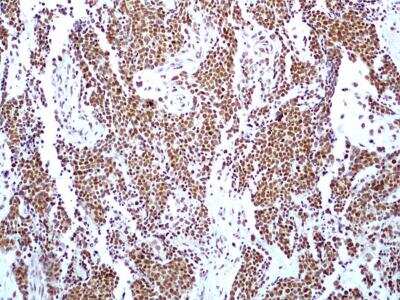 Immunohistochemistry-Paraffin: HMGB1/HMG-1 Antibody (19N15F4) [NBP2-27401]