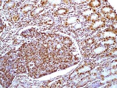 Immunohistochemistry-Paraffin: HMGB1/HMG-1 Antibody (19N15F4) [NBP2-27401]