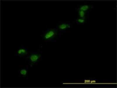 Immunocytochemistry/ Immunofluorescence: HMGB1/HMG-1 Antibody (1D5) [H00003146-M02]