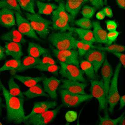 Immunocytochemistry/ Immunofluorescence: HMGB1/HMG-1 Antibody (1F3) [NBP2-25148]