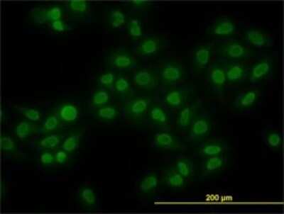Immunocytochemistry/ Immunofluorescence: HMGB1/HMG-1 Antibody (2F6) [H00003146-M08]