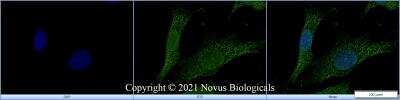 Immunocytochemistry/ Immunofluorescence: HMGB1/HMG-1 Antibody [NB100-2322]