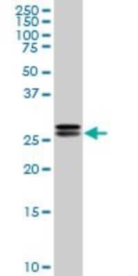Western Blot: HMGB2 Antibody (3E5) [H00003148-M05]