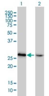 Western Blot: HMGB2 Antibody (4G7) [H00003148-M02]