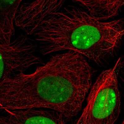 Immunocytochemistry/ Immunofluorescence: HMGB2 Antibody [NBP2-38694]