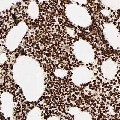 Immunohistochemistry-Paraffin: HMGB2 Antibody [NBP1-81731]