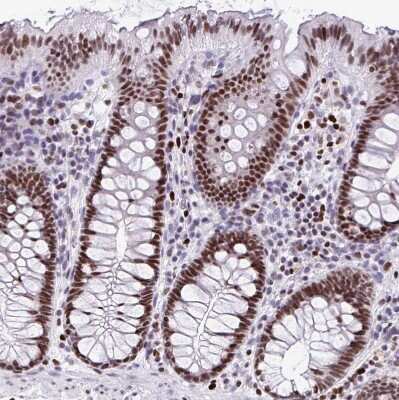 Immunohistochemistry-Paraffin: HMGB2 Antibody [NBP2-38694]